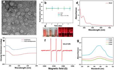 Construction of ultrasound-responsive urokinase precise controlled-release nanoliposome applied for thrombolysis